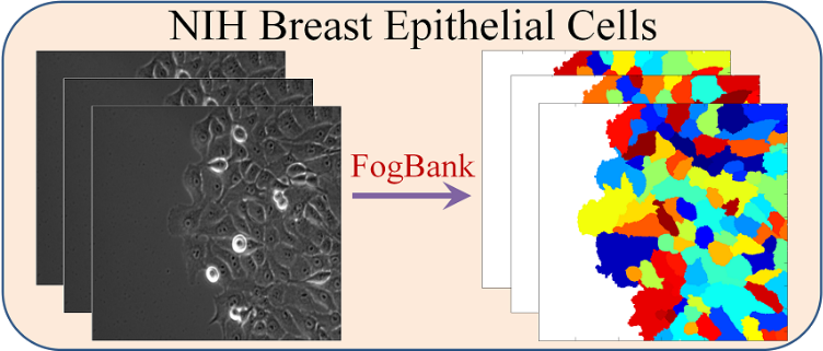Tracking Dataset: NIH MCF10A Breast Epithelial Cells